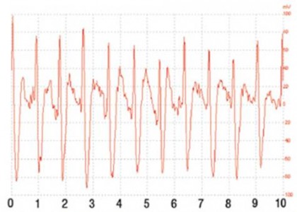 壓電薄膜傳感器在新型電子聽診器和生命體征方面的應用
