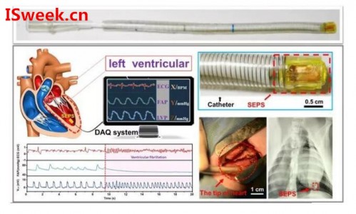 光纖壓力傳感器FOP-M260在心內壓評估的應用