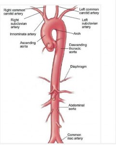 胸主動脈瘤手術過程中的壓力監控