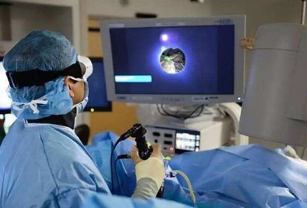 用于激光碎石過程壓力和溫度監控設備中的光纖傳感器