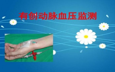 光纖壓力傳感器在有創動脈壓力檢測中的應用