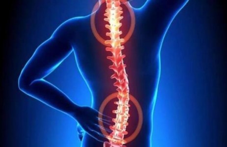 在椎間盤微創手術過程中壓力監控中應用到的光纖壓力傳感器