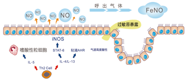 一氧化氮（FeNO）呼氣檢測在哮喘診斷和管理的應用